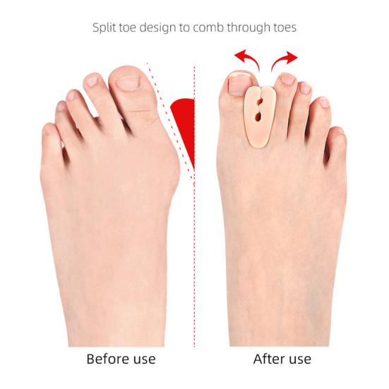 1 Pair Toe Separator Orthopedic Bunion Valgus Hammertoe Corrector Pain Relief Women Men Foot Alignment Overlapping Toe Spacer Straightener
