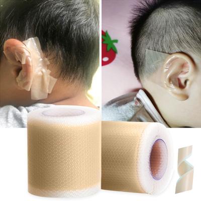 Ohrformer-Aufkleber, starke Klebrigkeit, selbstklebend, sanft schneidbar, leicht zu tragen, Korrektur, Mini-Kinder-Aufkleber für hervorstehendes Ohr, Kinderzubehör