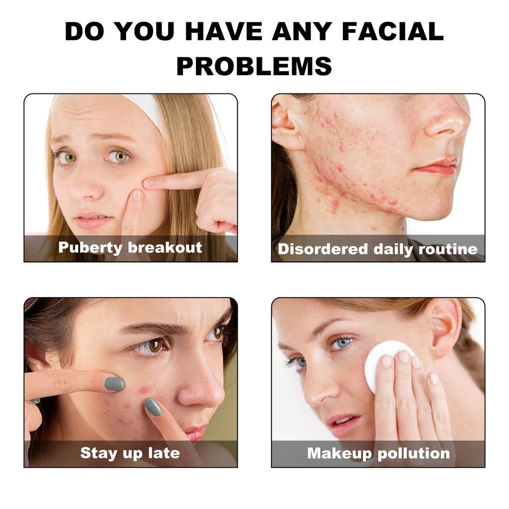 West Month Blue Acne Patches Gentle Deep Cleansing Repairing Spot Treatment For Clear Skin