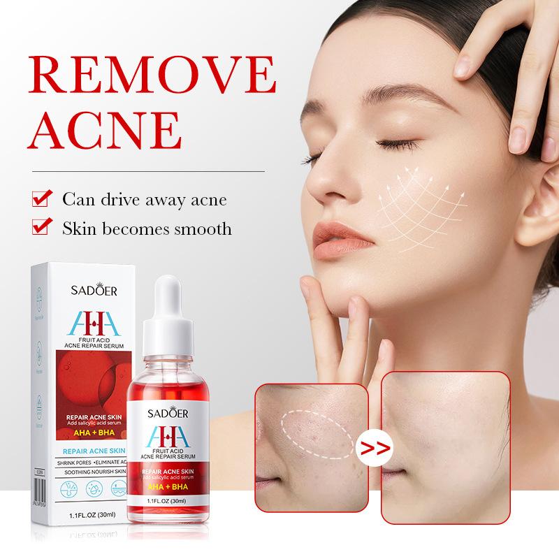 Acne Serum SADOER Fruit Acid Dilutes Acne Marks, Hydrates and Moisturizes