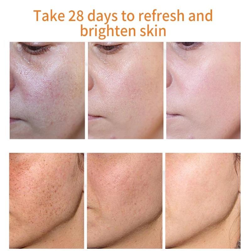 Sérum Blanchissant Anti-Taches Pigmentaires Correcteur de Mélanine Visage Taches de Rousseur Éclaircissant Beauté Soin de la Peau Coréen Jour Nuit