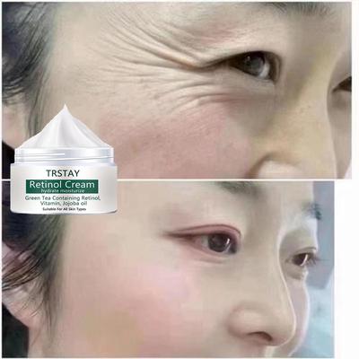 Retinol Moisturizing Cream, Smooths Wrinkles, Reduces Fine Lines, Hydrates and Moisturizes, Nourishes the Skin, and Improves Damaged Skin