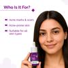 Derma Co 10% Niacinamid Serum mit 2% Zink gegen Aknenarben, fettige Haut und Pigmentflecken, 10 ml