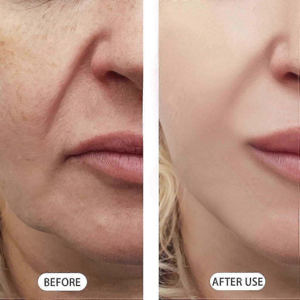 NAD+ PDRN Essenz Serum - Lifting Straffende Essenz, Peptide & Hyaluronsäure | Anti-Falten, Aufhellende Gesichtsbehandlung für reife Haut