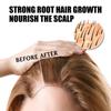 5% Minoxidil Biotin Hair Serum For Men And Women Dense Hair Serum Healthy Hair Penetrates Root To Tip