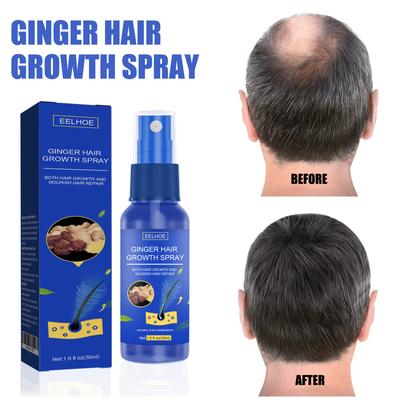 30ML Gember Haar Groei Spray Olie voor Haarverzorging Haar Groei Producten Haaruitval