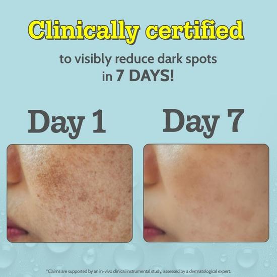 Chemist At Play 10% Vitamin C Face Serum |Brightens & Gives Glow |Fades Dark Spots |Treats Hyperpigmentation| Balances Melanin Production , 30ml