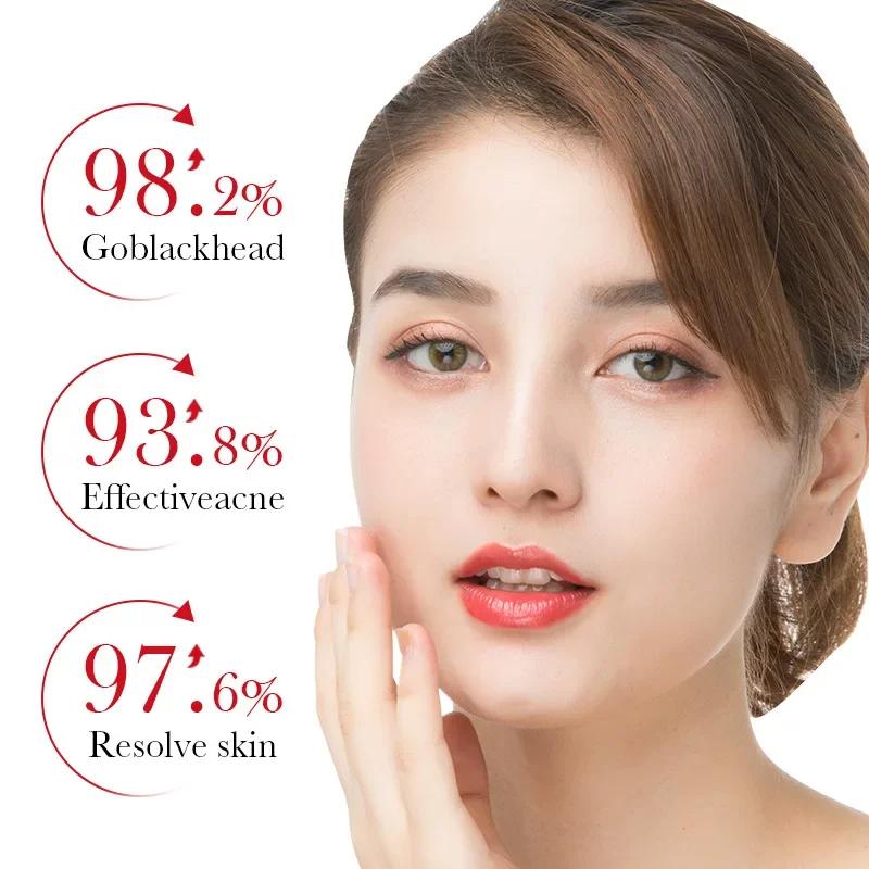 BIOAQUA Salicylic Acid Acne Removing Essence Face Serum Skincare Moisturizing Repairing Acne Treatment Facial Serum Skin Care