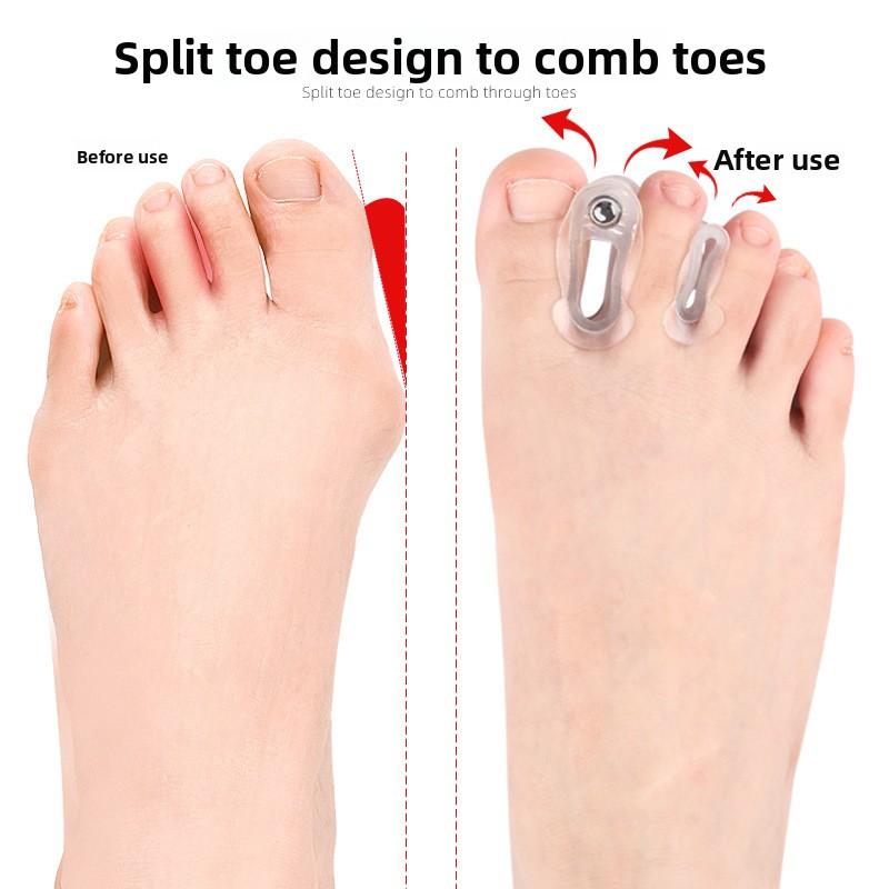 A-word Thumb Eversion Toe Splitter Magnet Shock Absorption Massage Clip Foot Forefoot Pad with Hole Thickened Foot Splitter