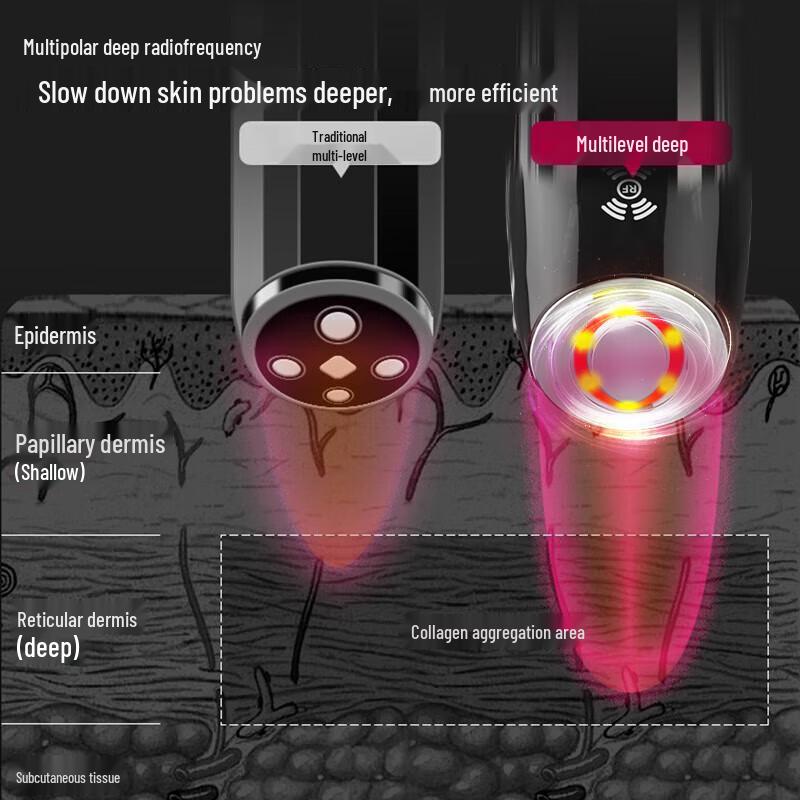 KONKA RF LED Microcurrent Facial & Eye Beauty Device