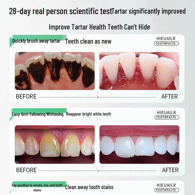 HIEUAILR Tartar Removal & Whitening Toothpaste