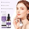 Korea Niacinamid Gesichtsserum Vitamin B3 Falten Pigment Dunkle Flecken Reduzieren Korrigierendes Glow Serum Gesichtsaufhellung Feuchtigkeitscreme