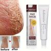 Chapped Feet Cream Fall and Winter Heel Anti-dry Crack Moisturizing Moisturizing Hydration Foot Repair Gel