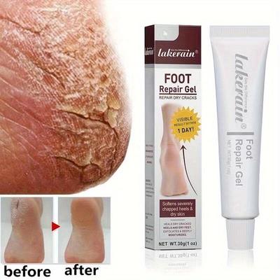 Crema per piedi screpolati Autunno e inverno Tallone Anti-secca Crepe Idratante Idratante Gel riparatore per i piedi