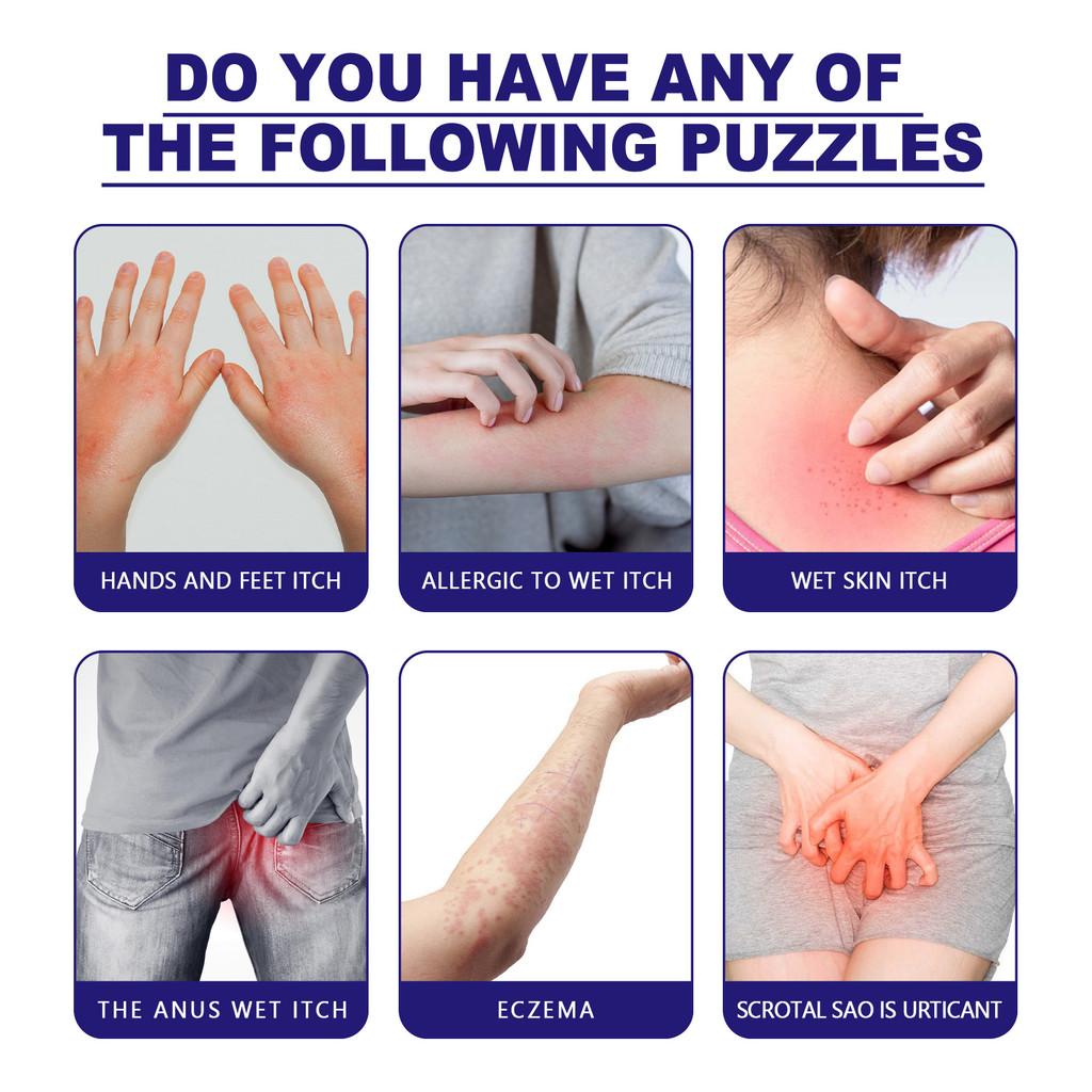 South Moon Purple Flower Skin Care Cream For Mosquito Bites And Redness Relief 30g Box