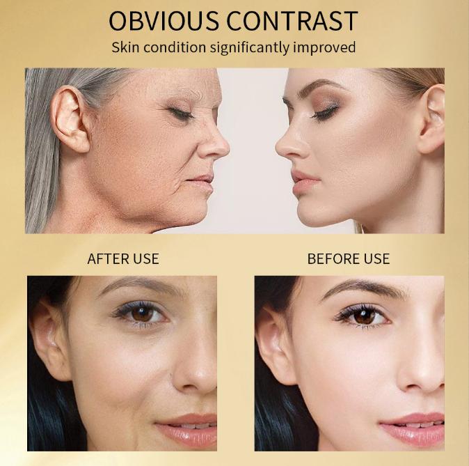 24K Gold Nicotinamide Serum - Anti-Aging & Hydrating Face Treatment, 99.9% Pure Gold + Niacinamide,Glowing, Firm & Plump Skin