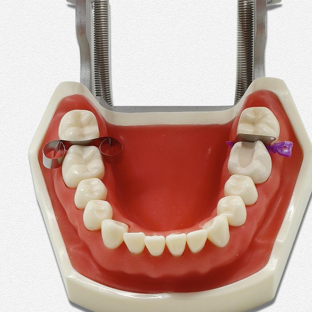 Dental Matrix Wedge Guards Sectional Baffle Type Matrice Teeth Interproximal Wedge Knife With Protection Steel Matrix Dentistry