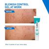CeraVe Blemish Control Gel 40ml with 2% Salicylic Acid for Acne Spot Treatment