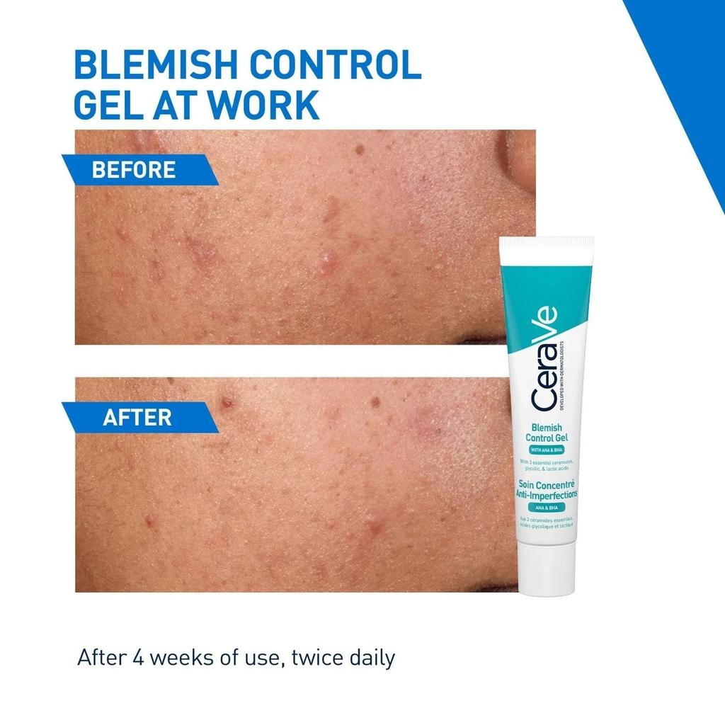 CeraVe Blemish Control Gel 40ml with 2% Salicylic Acid for Acne Spot Treatment