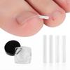 50Pcs/box Filling Pad Ingrown Toenail Correction Tool Straightening Clip