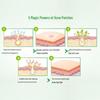 Mentholatum Acnes Invisible Pimple Patches