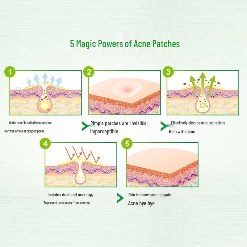 Mentholatum Acnes Invisible Pimple Patches
