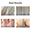 HOMZY Portable IPL Laser Epilator 999999 Flashes - Painless, Permanent Hair Removal for Women’s Body and Bikini Line