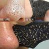 Nose Blackhead Remover Mask Deep Cleansing Skin Care Shrink Pore Acne Treatment Mask Nose Black Dots Pore Clean Strips