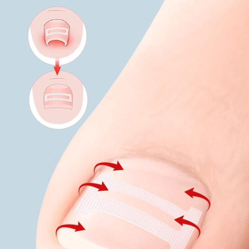 10 Pieces Ingrown Toenail Correction Kit Flexible Toenail Strips Toenail Straightener Thick Toenail Recovery for Adults