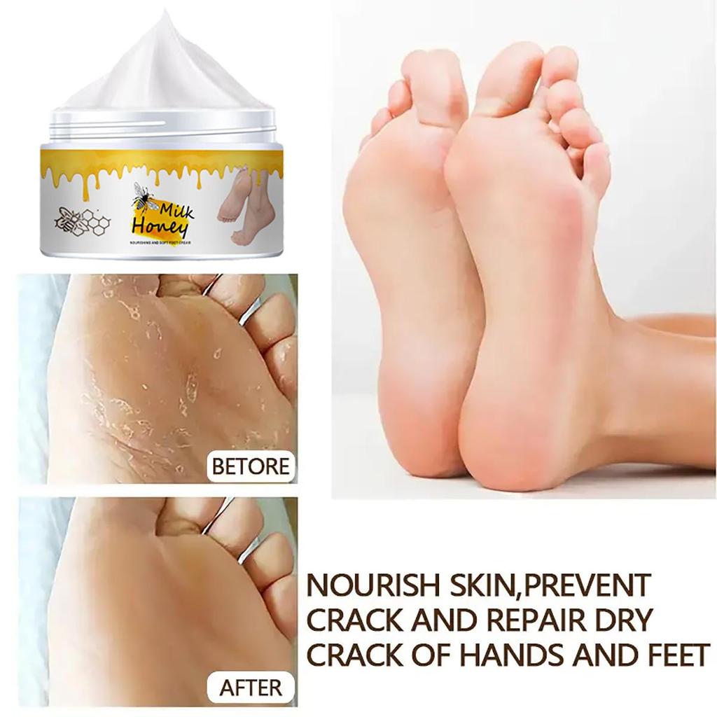 Sprukne hender og føtter reparerer krem, fukter, gir næring til huden og etterlater huden myk og delikat