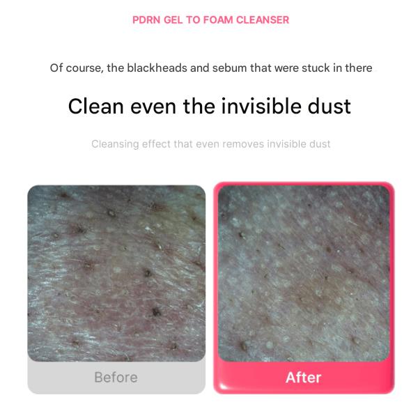 Medicube PDRN Gel-to-Foam Cleanser 200 Ml (3 Options)