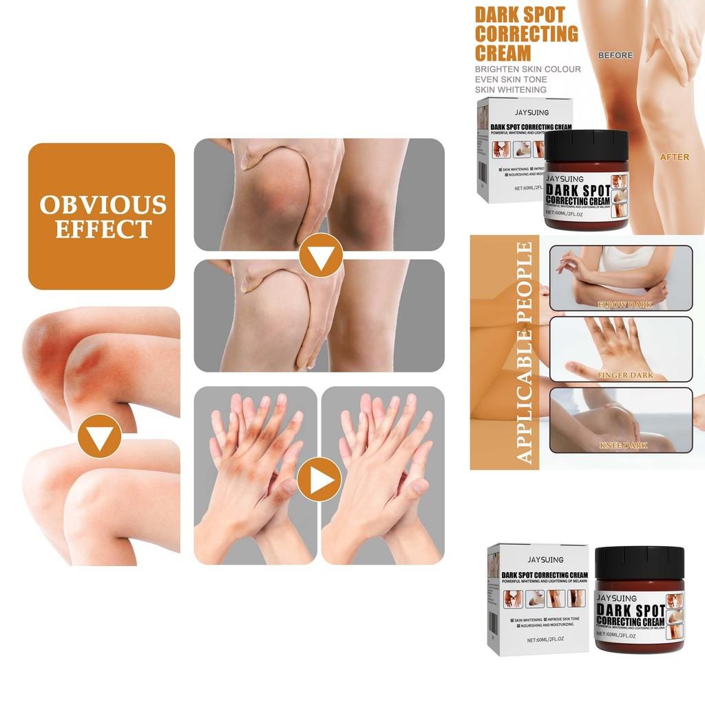 Jaysuing Moisturizing Cream For Joints Hydrating Body Care Lotion For Elbows And Knees