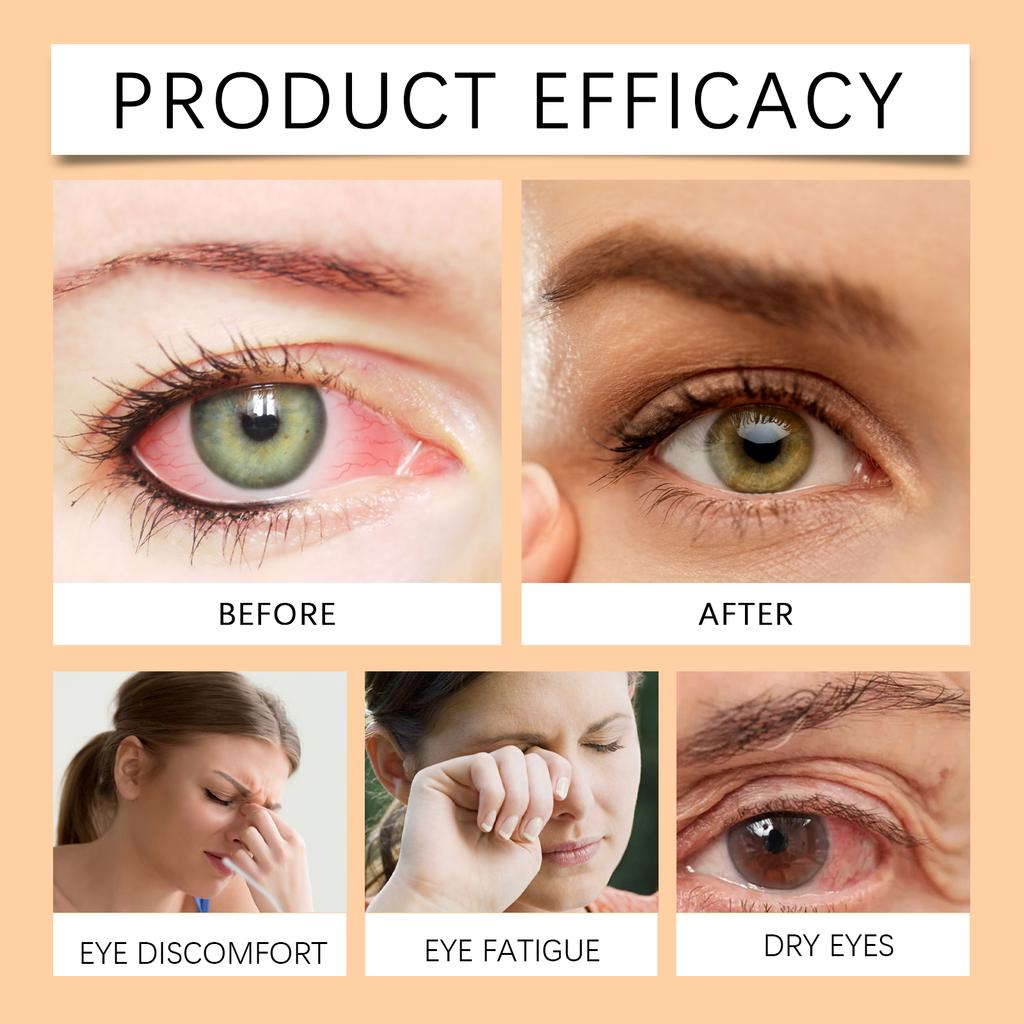 Miel Cuidado de Ojos Líquido Sérum Hidratante para Ojos Suave Solución Diaria para el Cuidado de los Ojos Refrescante Hidratante Cuidado de la Piel de los Ojos