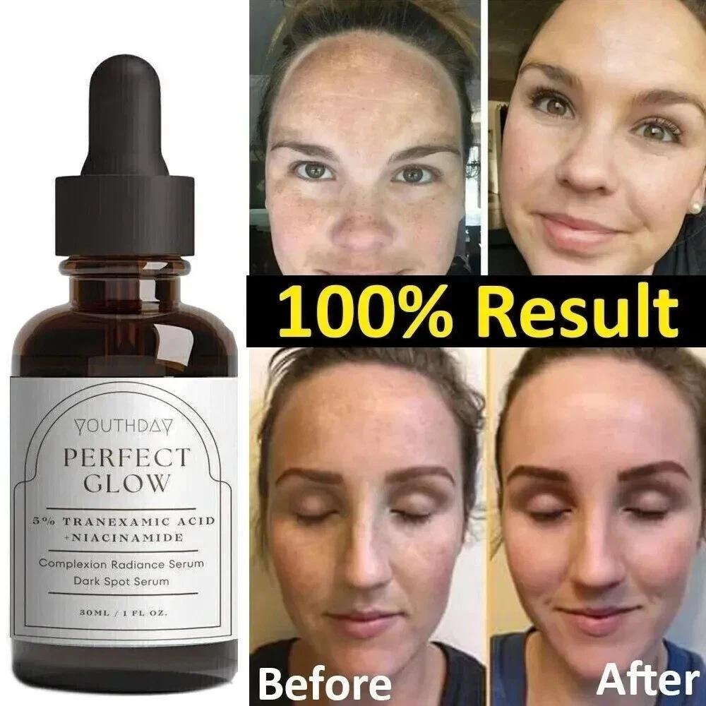 Face Serum with Tranexamic Acid and Niacinamide – Brightening, Hydrating & Firming Care for Even Skin Tone (30ml) Skin Care Serum Restoration