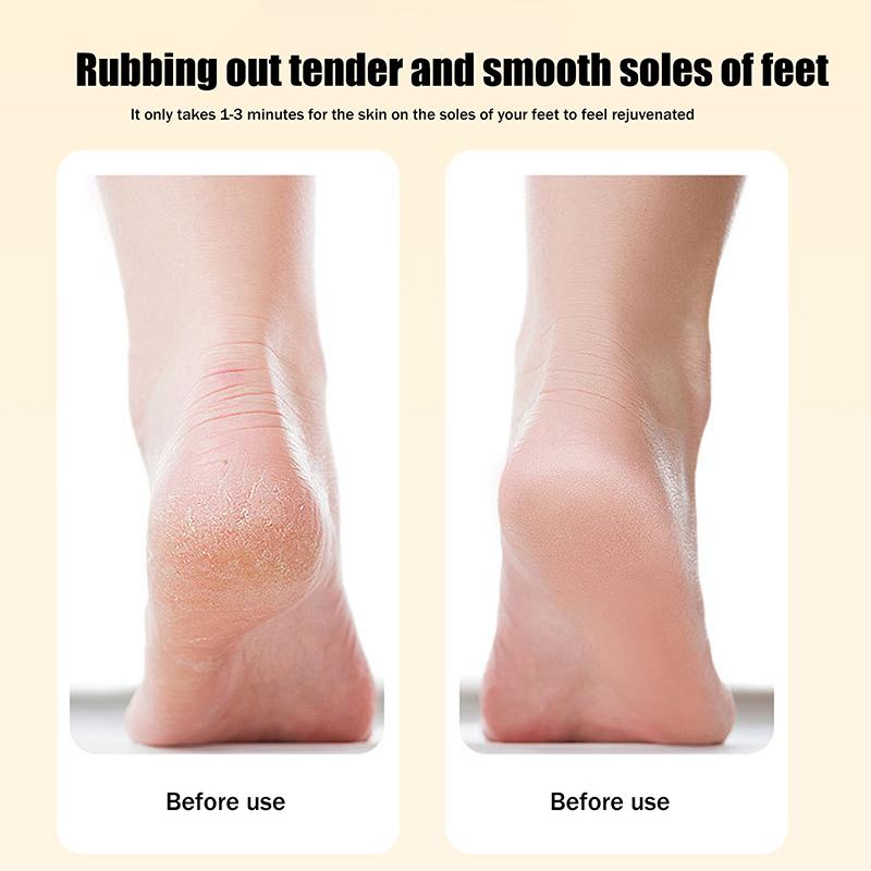 1Pcs Pedicure Foot File Tools Professional Dead Skin Callus Removal Stainless Steel Ergonomic Handle For Smooth Feet
