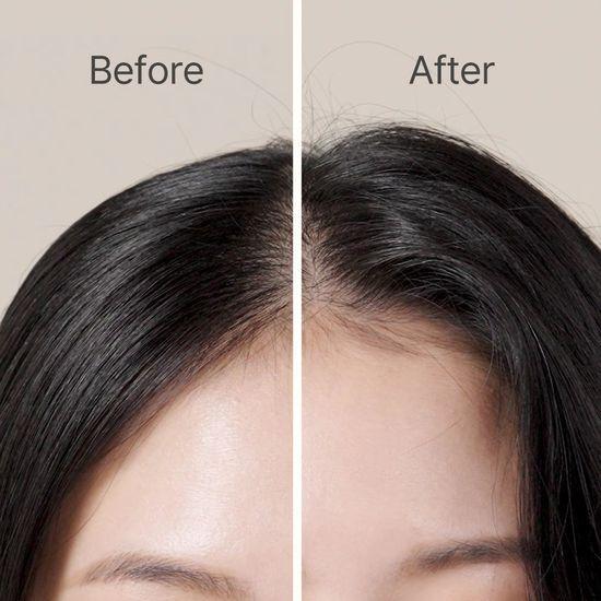 Ryo Rootzen Hair Loss Treatment Hair Volume Filler 150ml + Shampoo 100ml