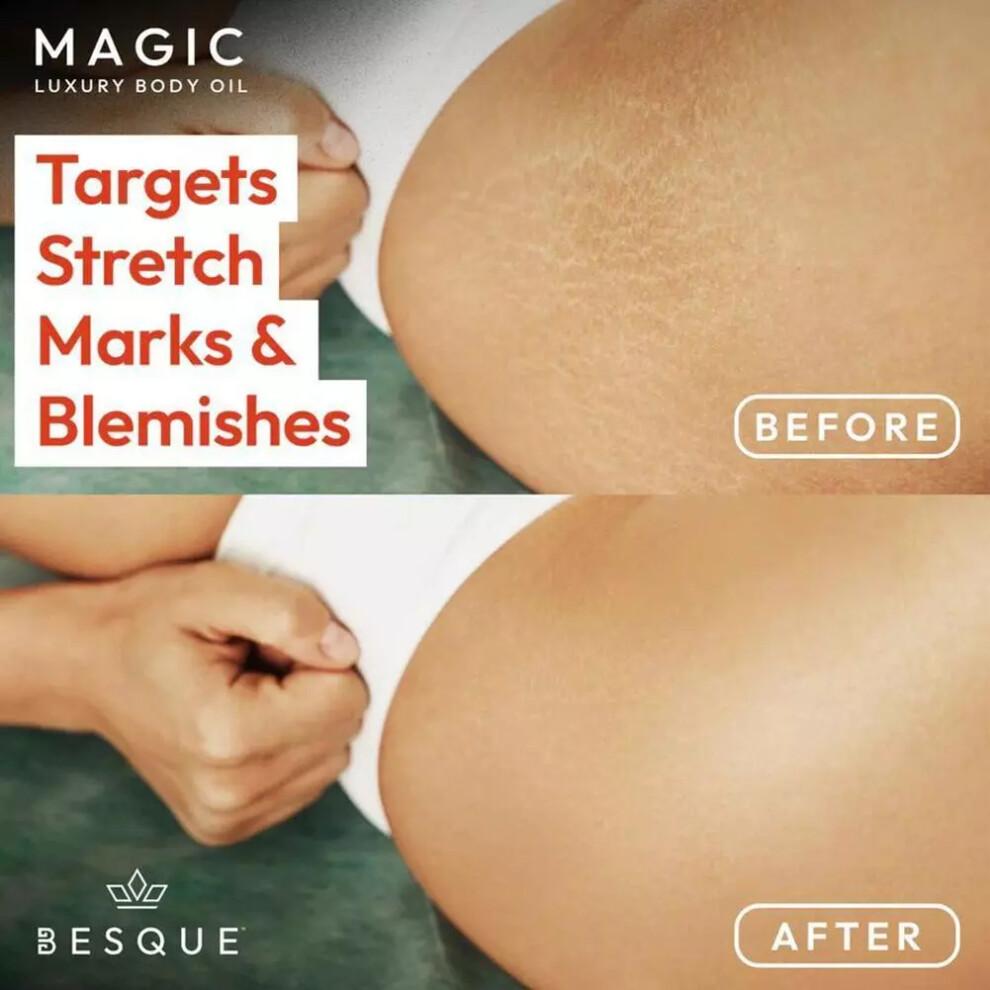 3pcs  100ml Magic Body Oil - Firms, Tightens & Hydrates Sagging Skin (Full-Body Use; Arms, Chest, Thighs & Tummy)