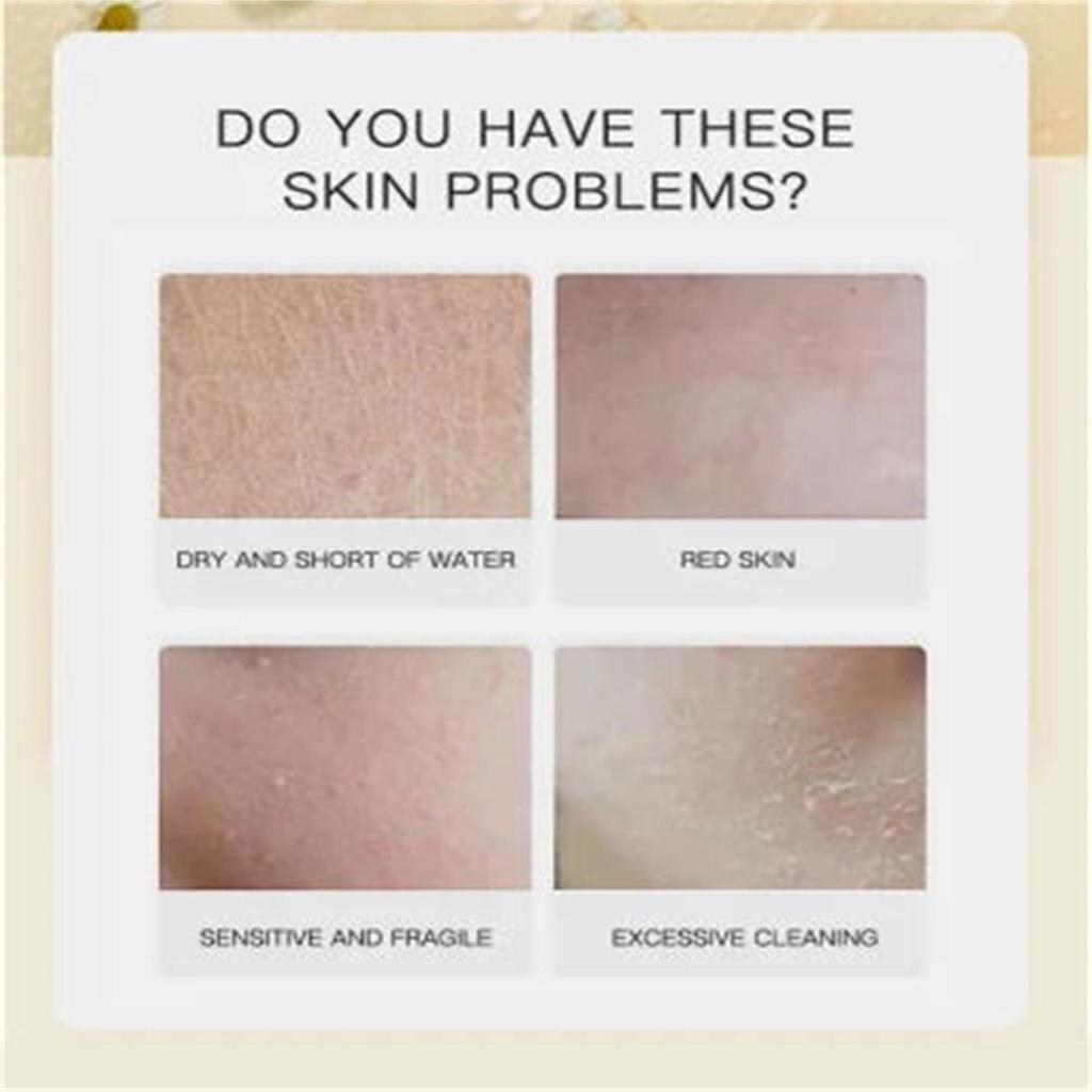 Dark Spot For Face, Dark Spot Corrector Cream, Ingredient, Enriching Skin Care For All Skin Tones, Melasma, Freckle, Sun Spot Improving