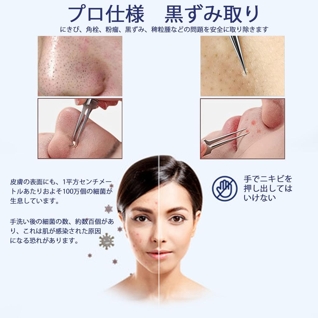 Eize Blackhead Removal Blast Precision Tweezers for Blackhead Blackhead Acne Pore Nose Whitehead Restore Clean Stainless Steel [2025 Latest] Tweezers,