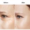 5pcs Face Lift Serum Ageness Anti Wrinkle Anti Aging Eye Cream