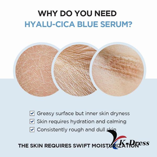 Skin1004 Madagascar Centella Hyalu-CICA Blue Serum 50ml