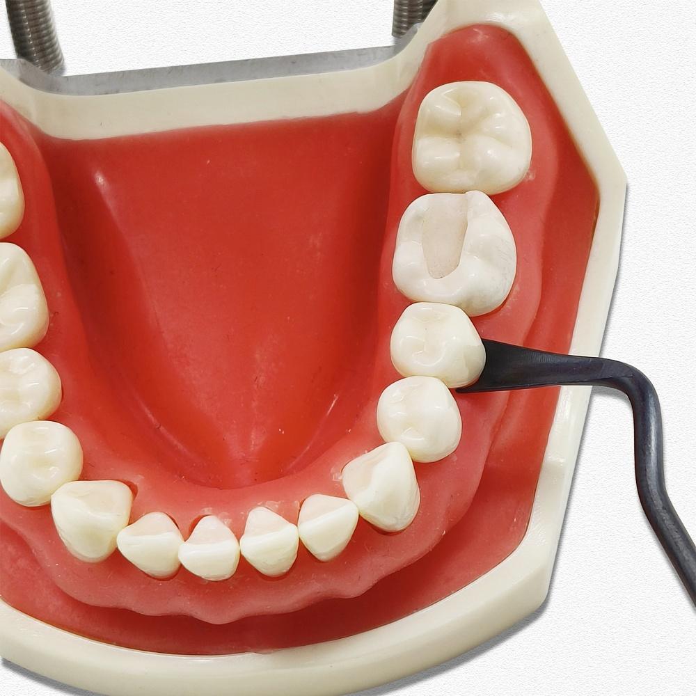 1 Pc or 2 Pcs or 3 Pcs Titanium Dental Implant Gingival Retraction Dental Gum Separator Isolation Surgical Tool Gingival Retractor Double Ends