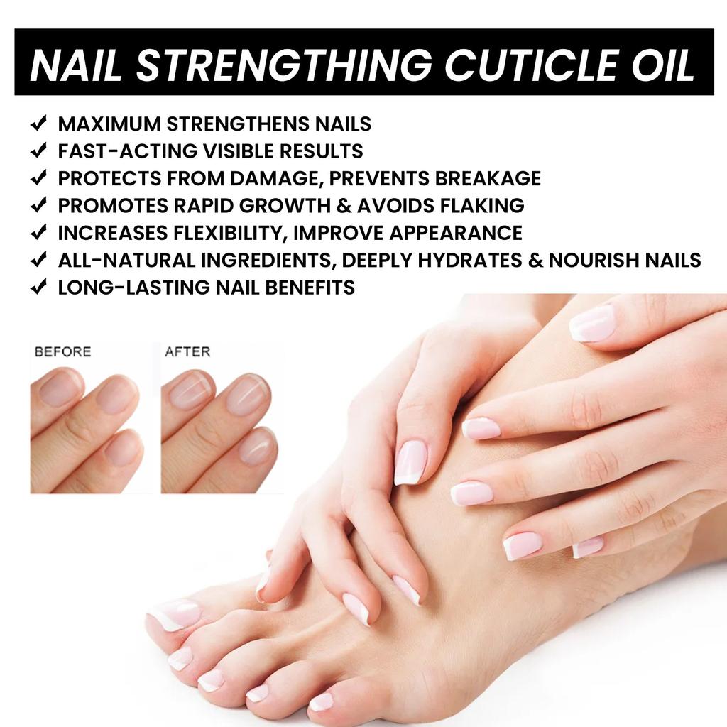 15ml Nail Strengthening Cuticle Oil, Nail Care Moisturizing And Brightening Nails, Care Oil