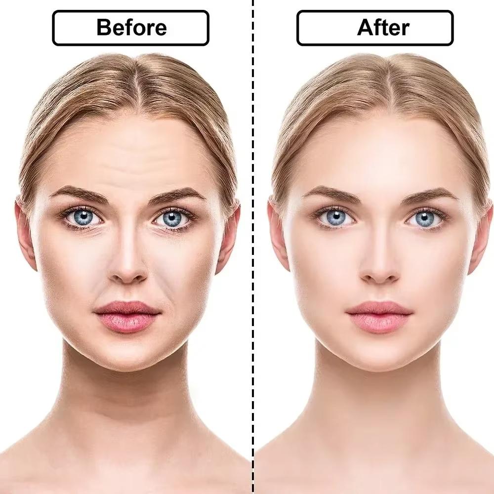 Wiederverwendbare Silikon-Faltenentfernungsaufkleber Anti-Falten-Pads Anti-Aging-Haut Gesichtsstraffungs-Pflaster Gesicht Stirn Hals Augenaufkleber