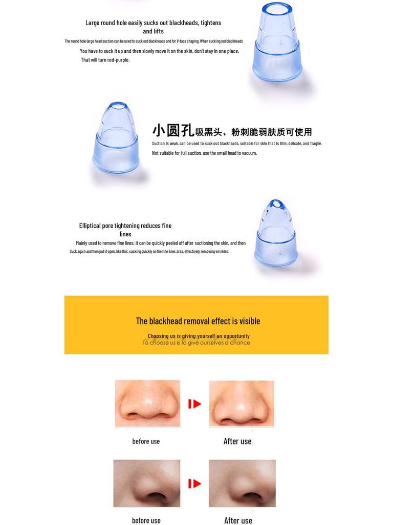 Hot Selling Blackhead Remover Pore Cleaner Beauty Set