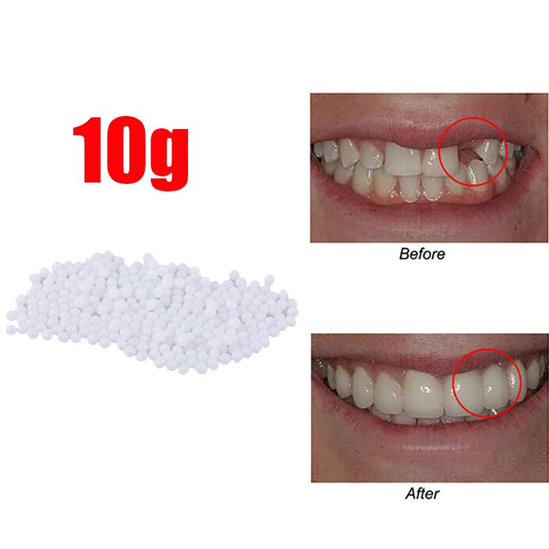 10g-100/bag Tooth Repair Kit-thermal Beads For Filling Fix The Missing And Broken Tooth Or Adhesive The Denture Fake Teeth Gutta