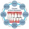 Rapid Repair Gums Gel Effectively Relieve Tooth Allergy Dental Caries Tooth Cleaning Toothpaste Relieve Tooth Damage Serum
