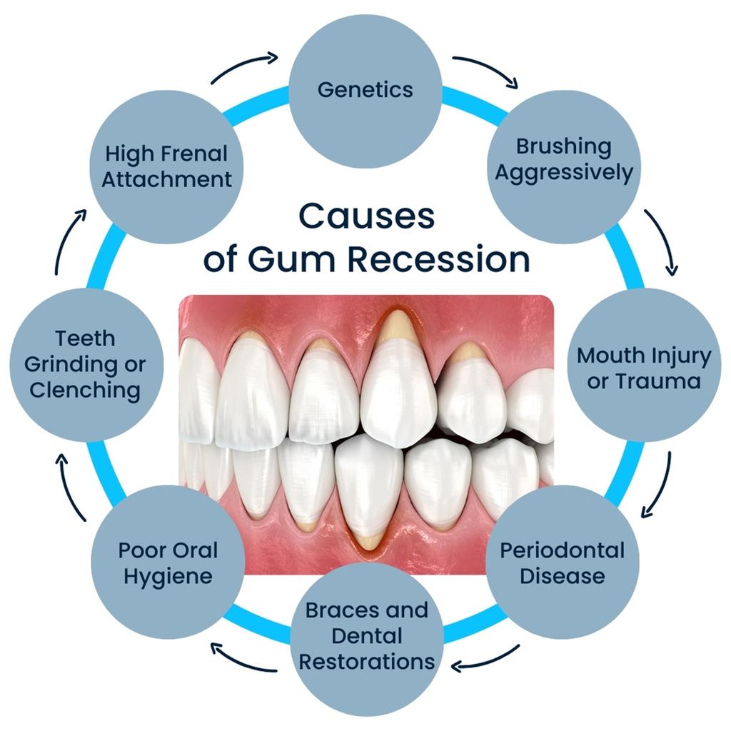 Rapid Repair Gums Gel Effectively Relieve Tooth Allergy Dental Caries Tooth Cleaning Toothpaste Relieve Tooth Damage Serum