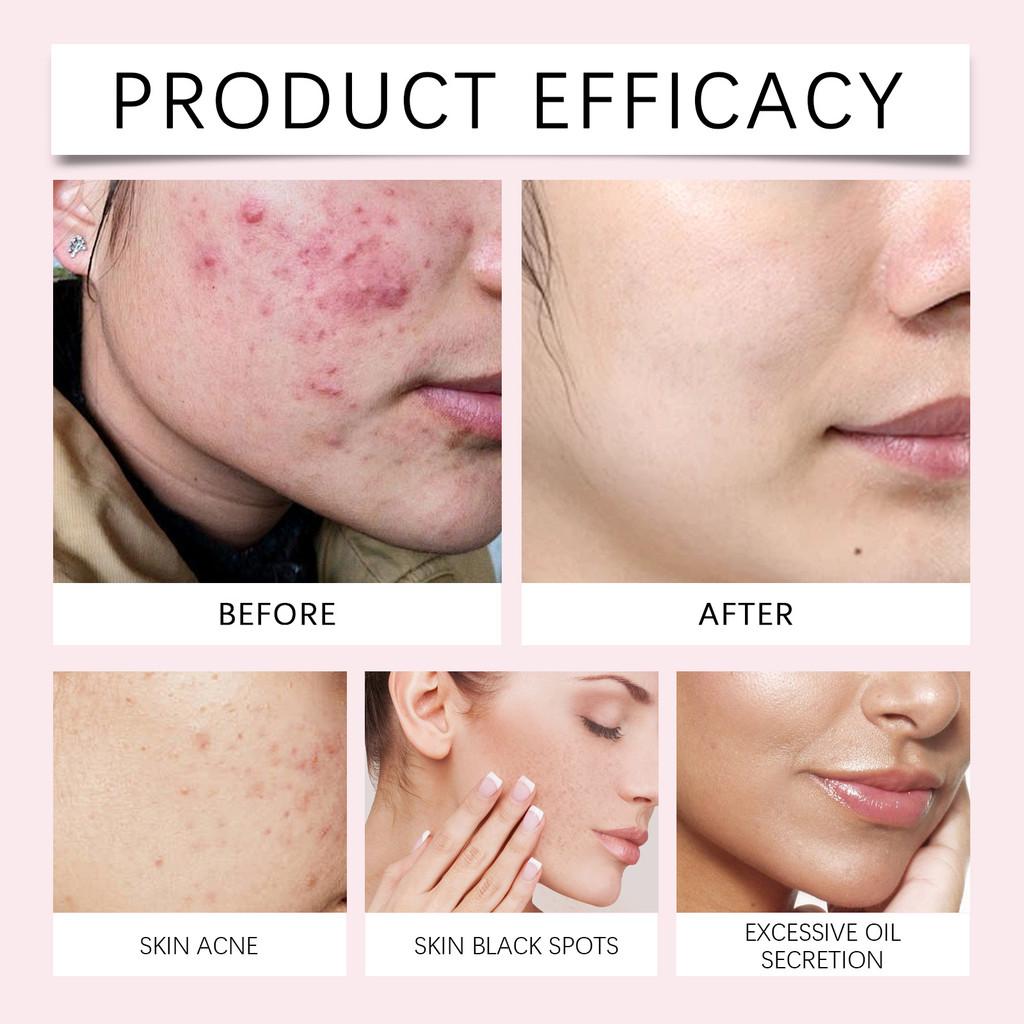 Eelhope Turmeric Cleansing Pads Gentle Hydrating Facial Skin Care For Moisturizing