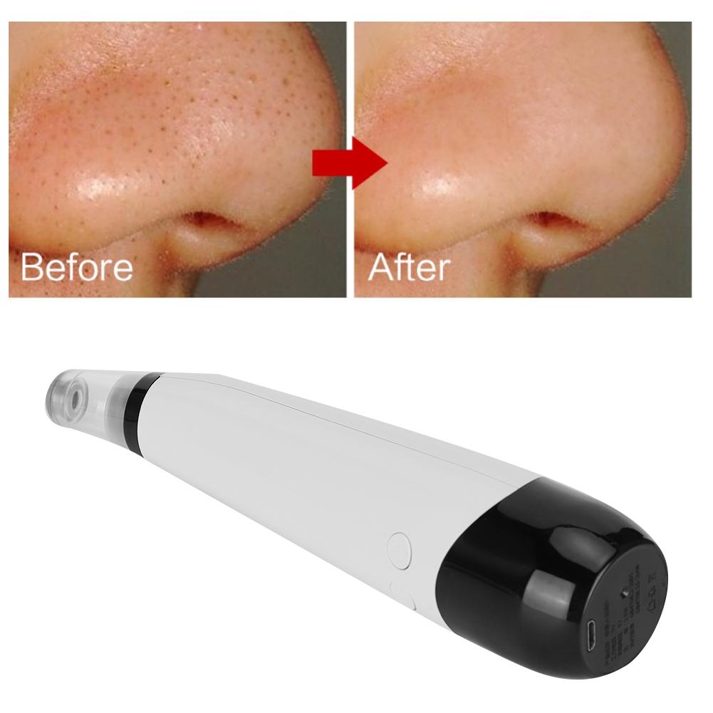 Professional Household Blackhead Removal Vacuum Suction Instrument Face Pore Cleaner